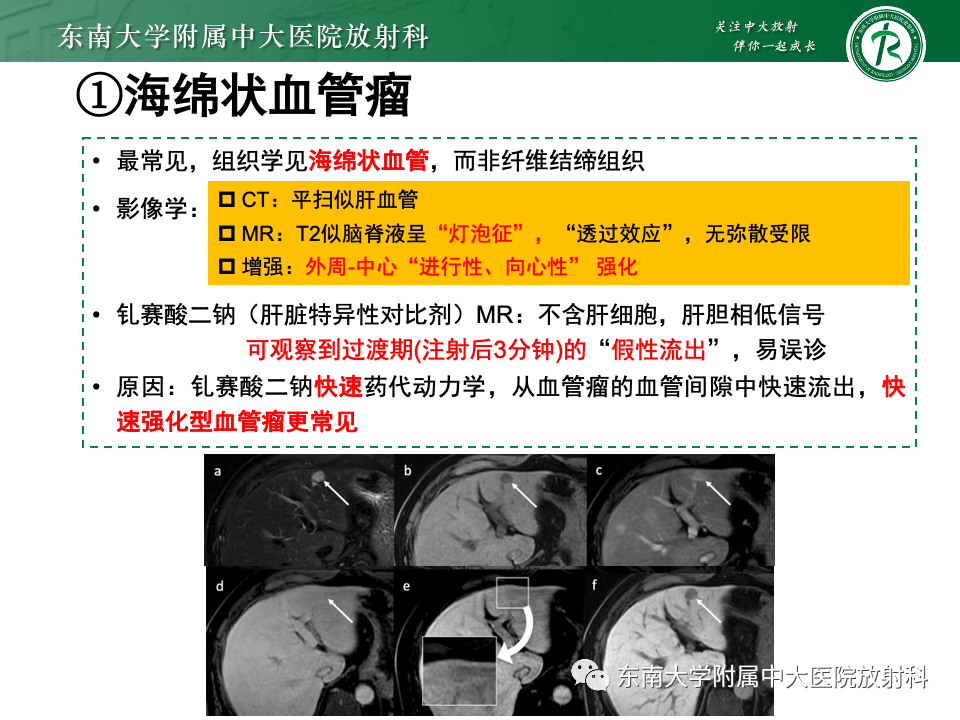 影像PPT - 【PPT】肝内多房囊性占位病例随访-15