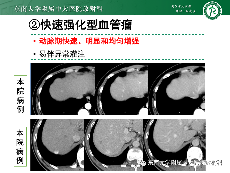 影像PPT - 【PPT】肝内多房囊性占位病例随访-17
