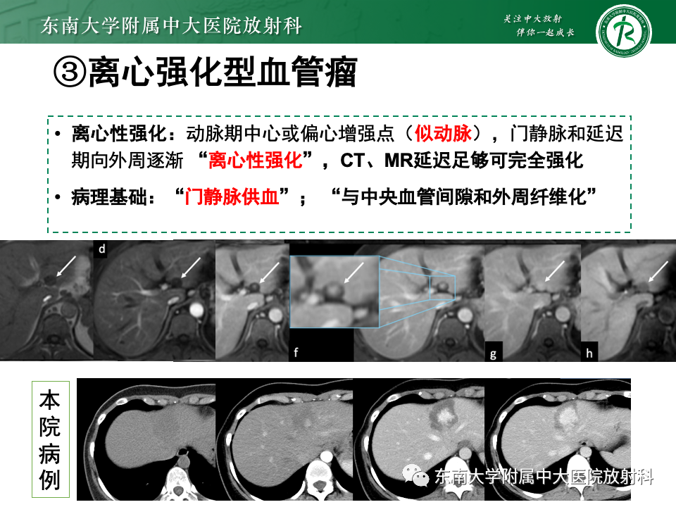 影像PPT - 【PPT】肝内多房囊性占位病例随访-18