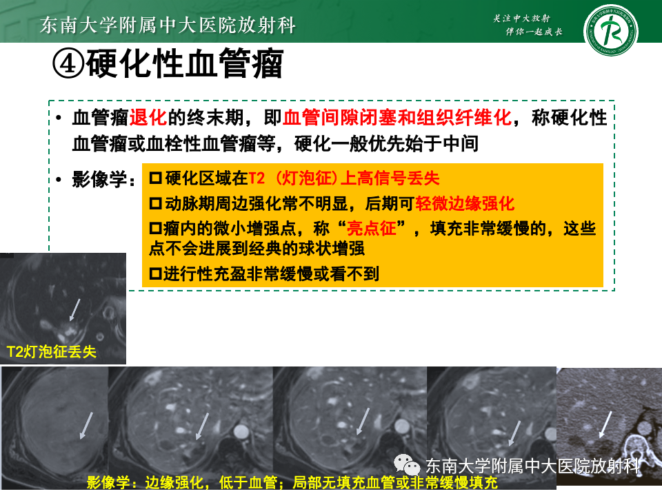影像PPT - 【PPT】肝内多房囊性占位病例随访-19