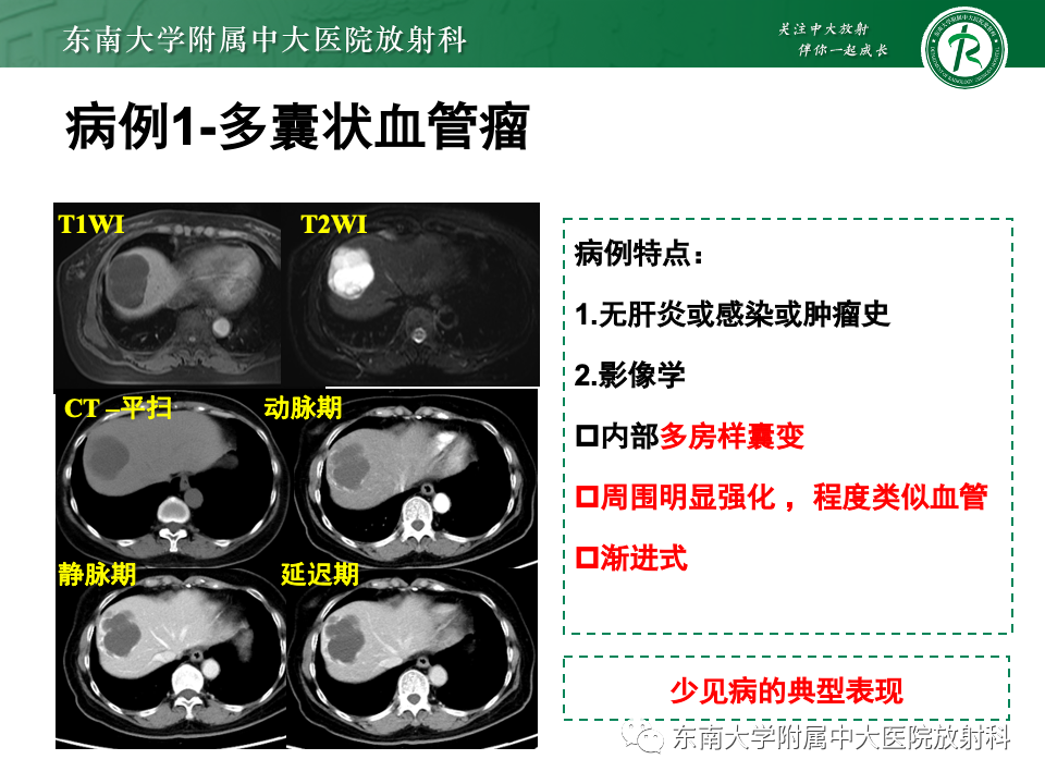 影像PPT - 【PPT】肝内多房囊性占位病例随访-22