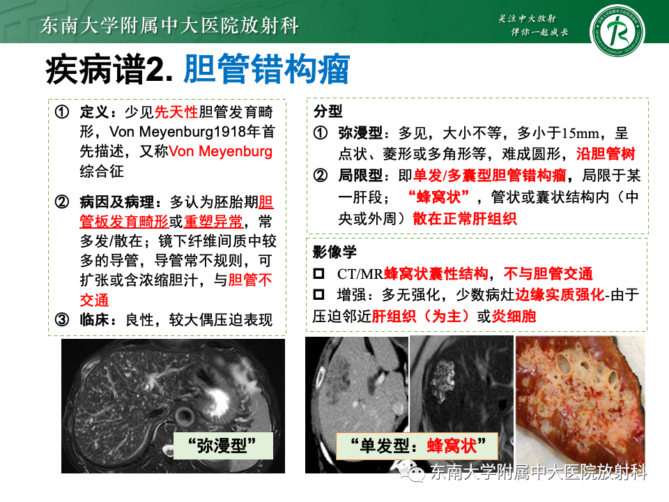 影像PPT - 【PPT】肝内多房囊性占位病例随访-23