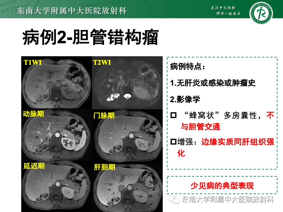 影像PPT - 【PPT】肝内多房囊性占位病例随访-25