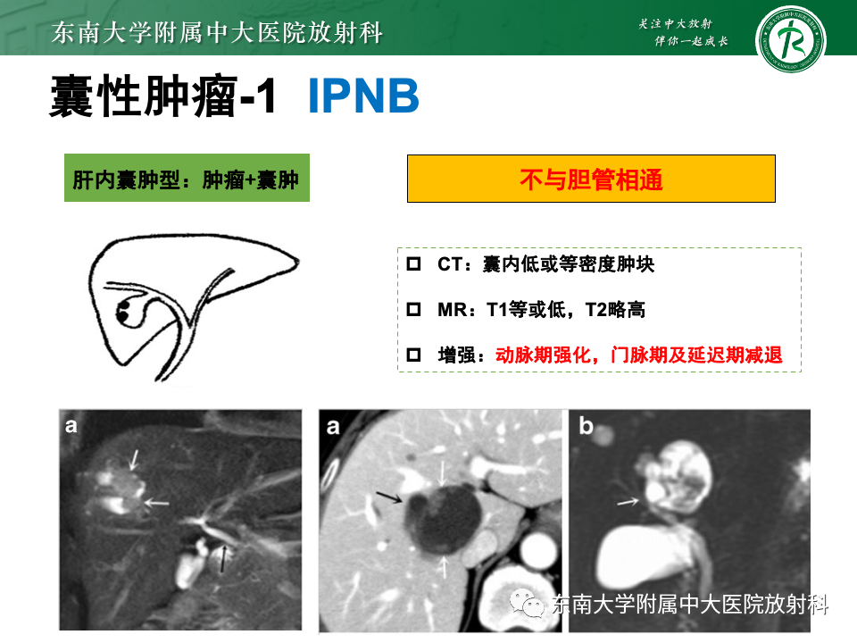 影像PPT - 【PPT】肝内多房囊性占位病例随访-29