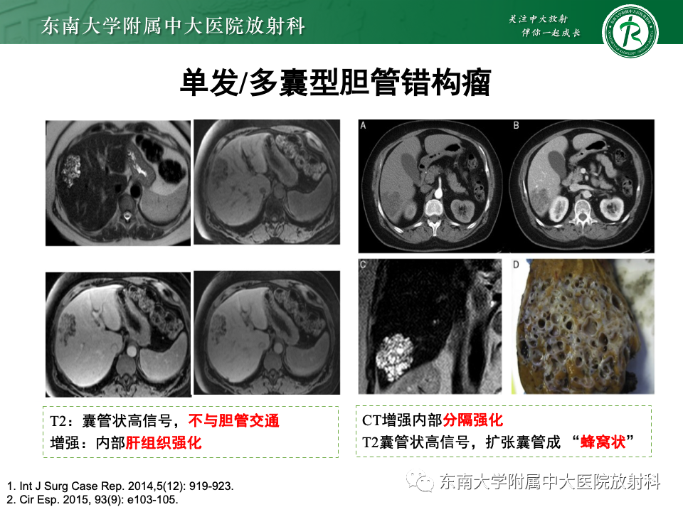 影像PPT - 【PPT】肝内多房囊性占位病例随访-24