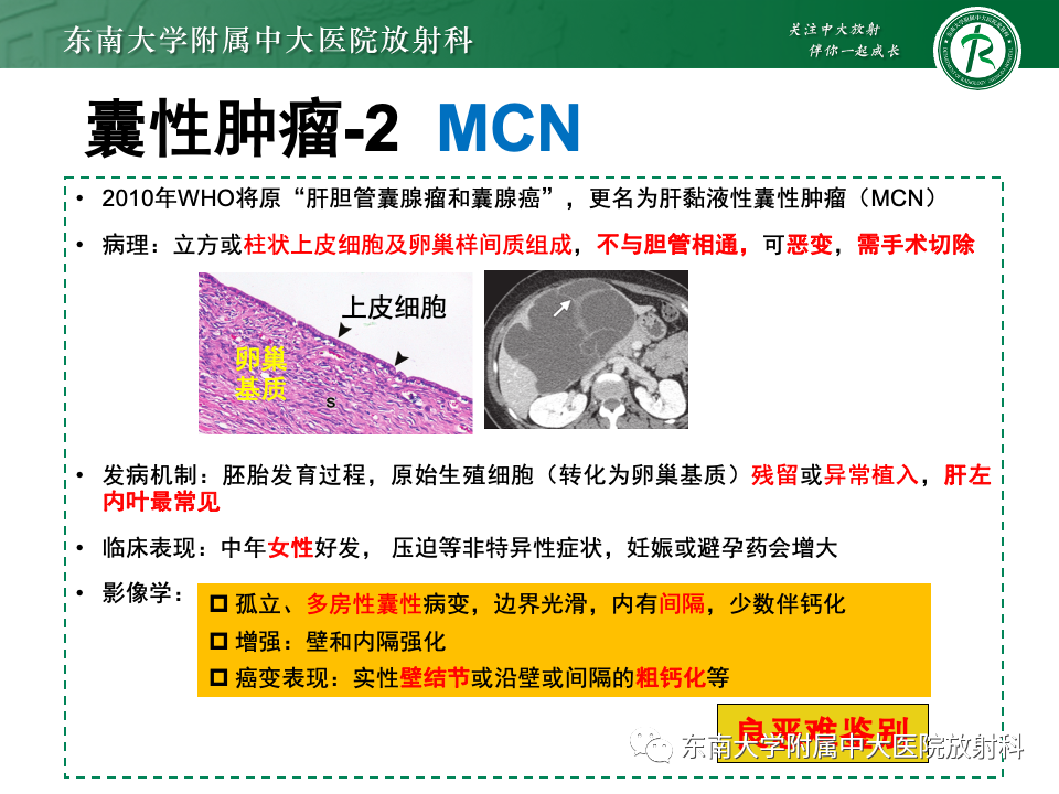 影像PPT - 【PPT】肝内多房囊性占位病例随访-31
