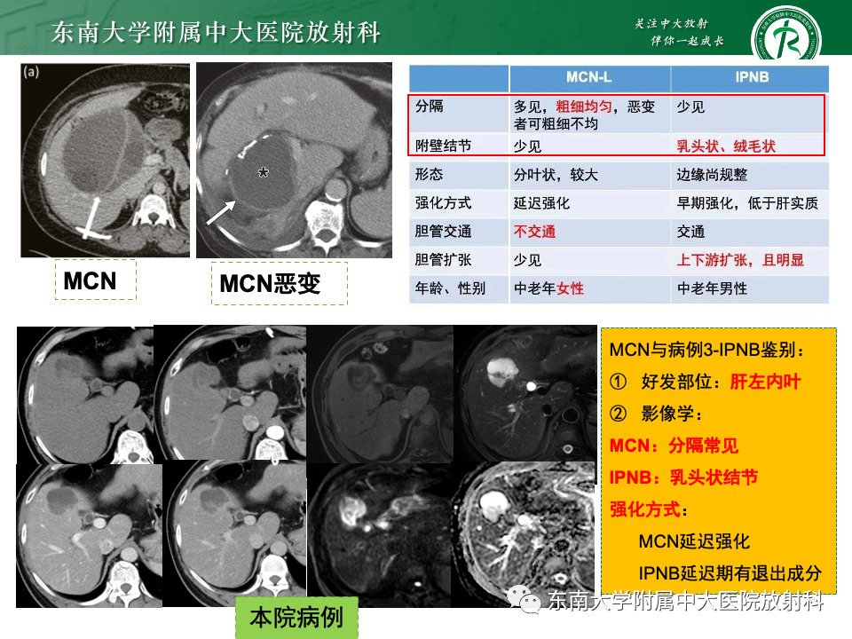 影像PPT - 【PPT】肝内多房囊性占位病例随访-32