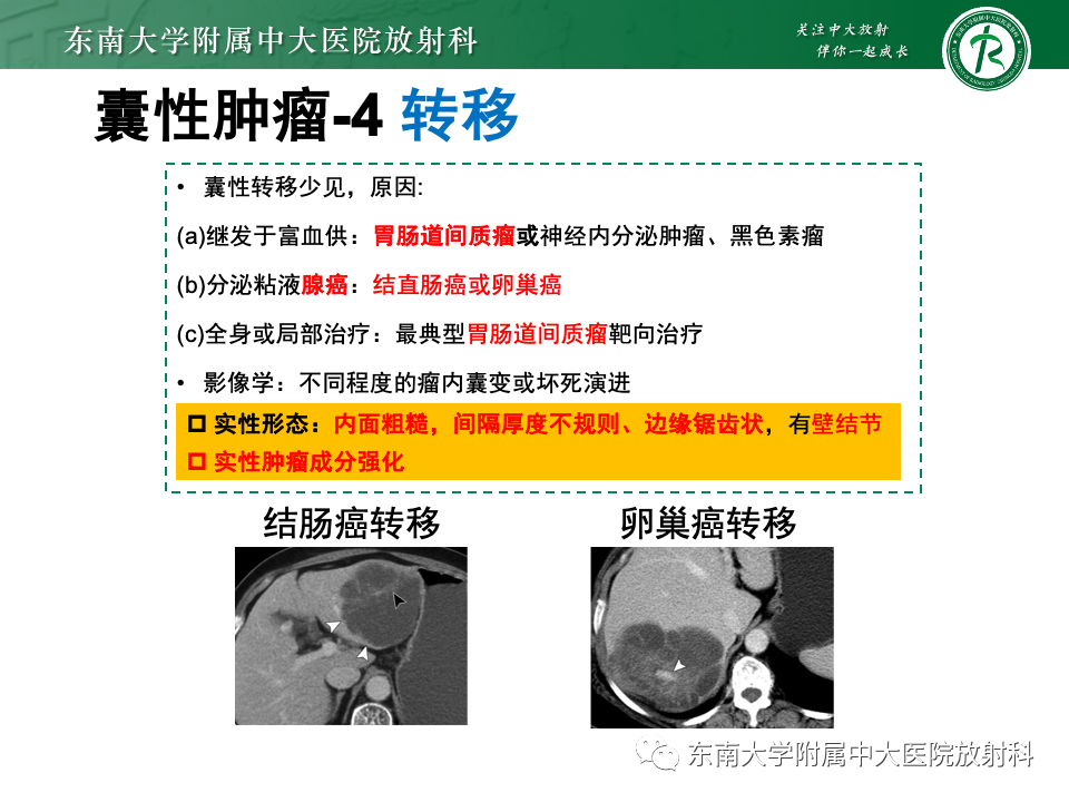 影像PPT - 【PPT】肝内多房囊性占位病例随访-34