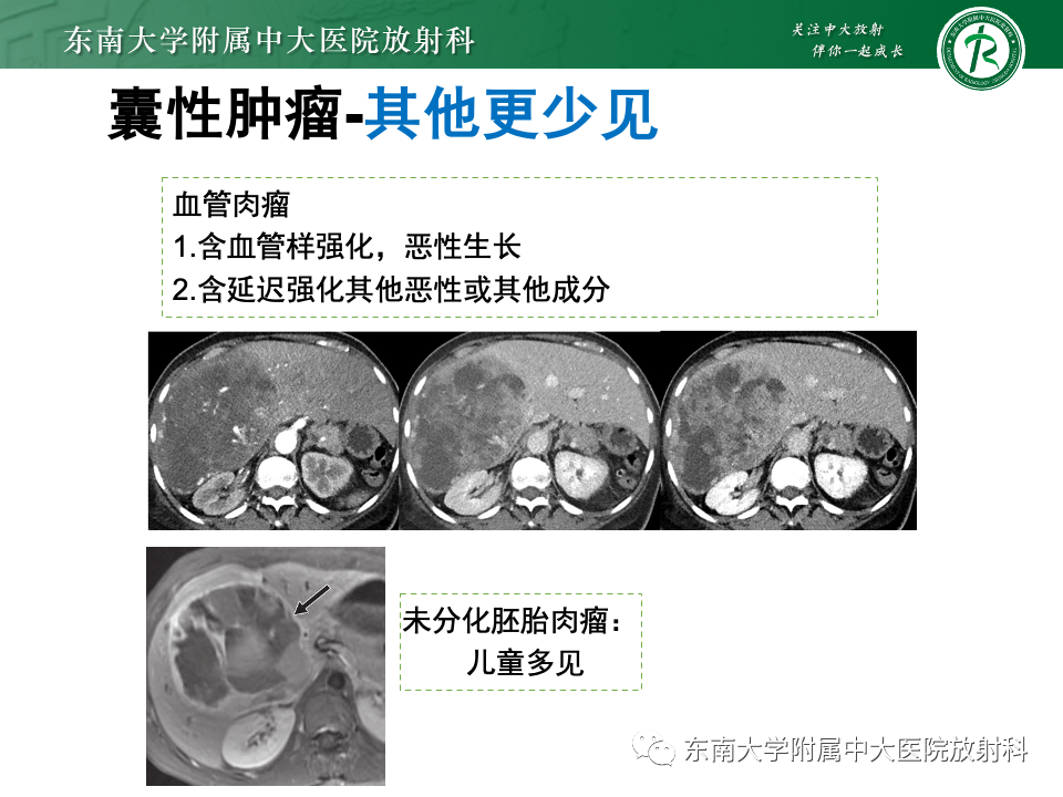 影像PPT - 【PPT】肝内多房囊性占位病例随访-36