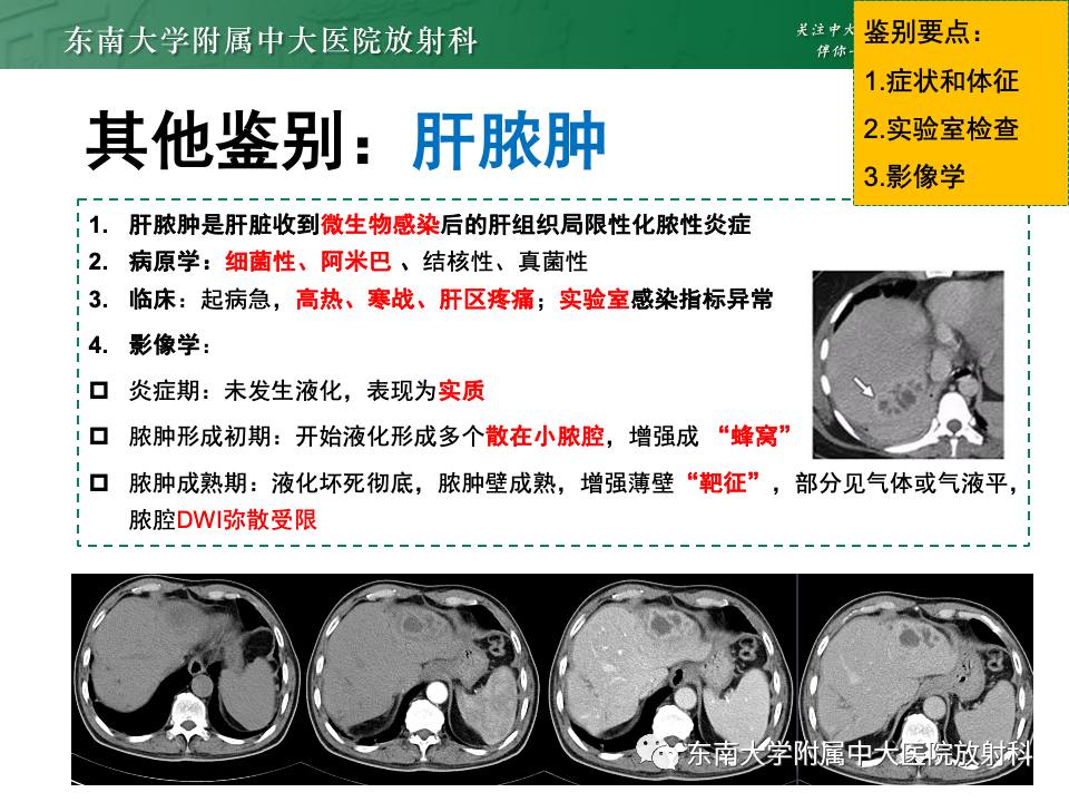 影像PPT - 【PPT】肝内多房囊性占位病例随访-37