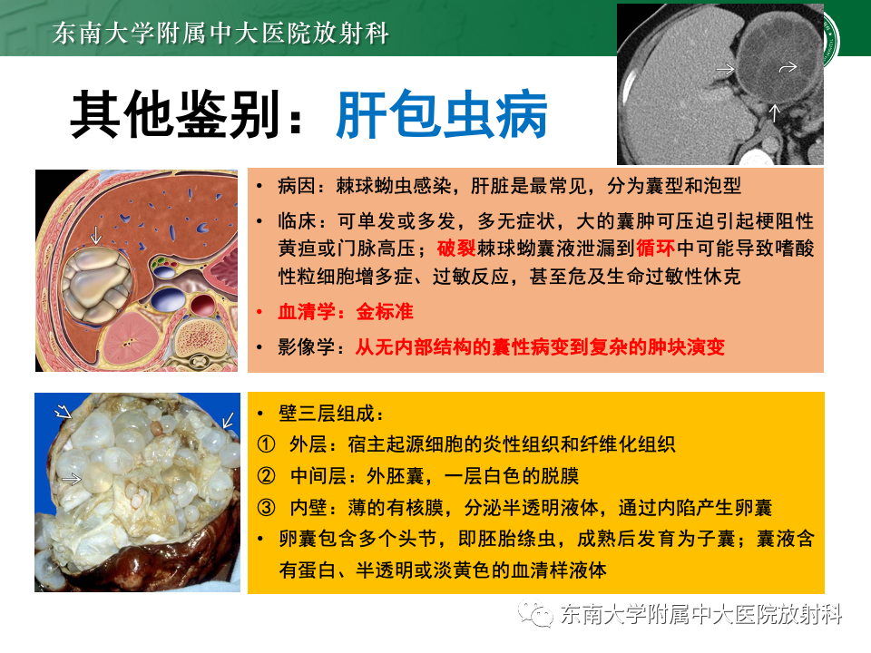影像PPT - 【PPT】肝内多房囊性占位病例随访-38