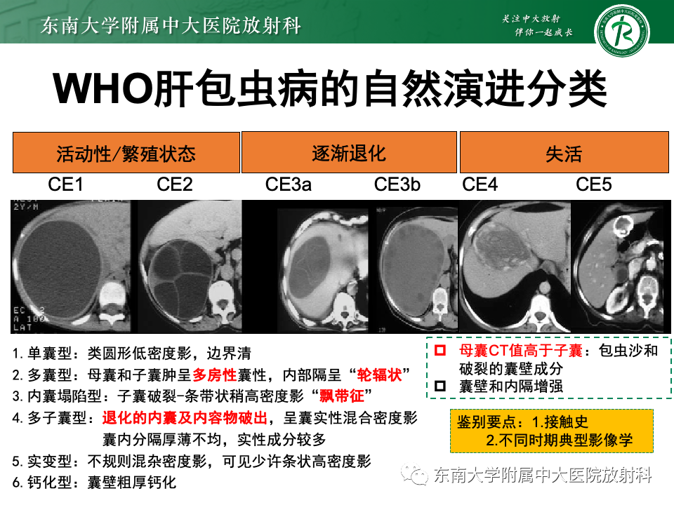 影像PPT - 【PPT】肝内多房囊性占位病例随访-39