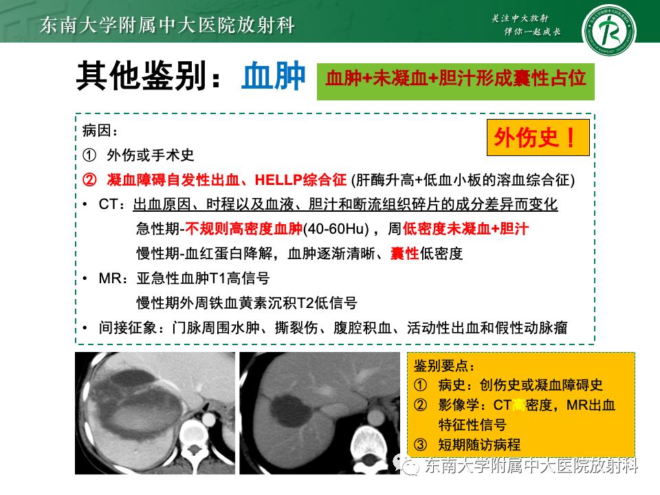 影像PPT - 【PPT】肝内多房囊性占位病例随访-40