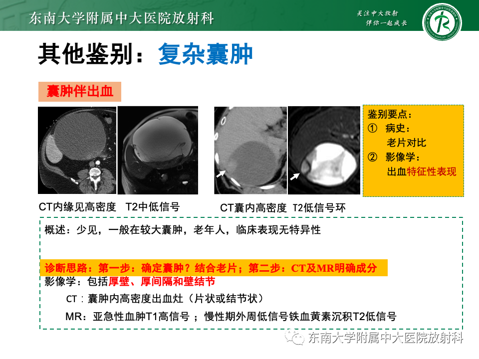 影像PPT - 【PPT】肝内多房囊性占位病例随访-42