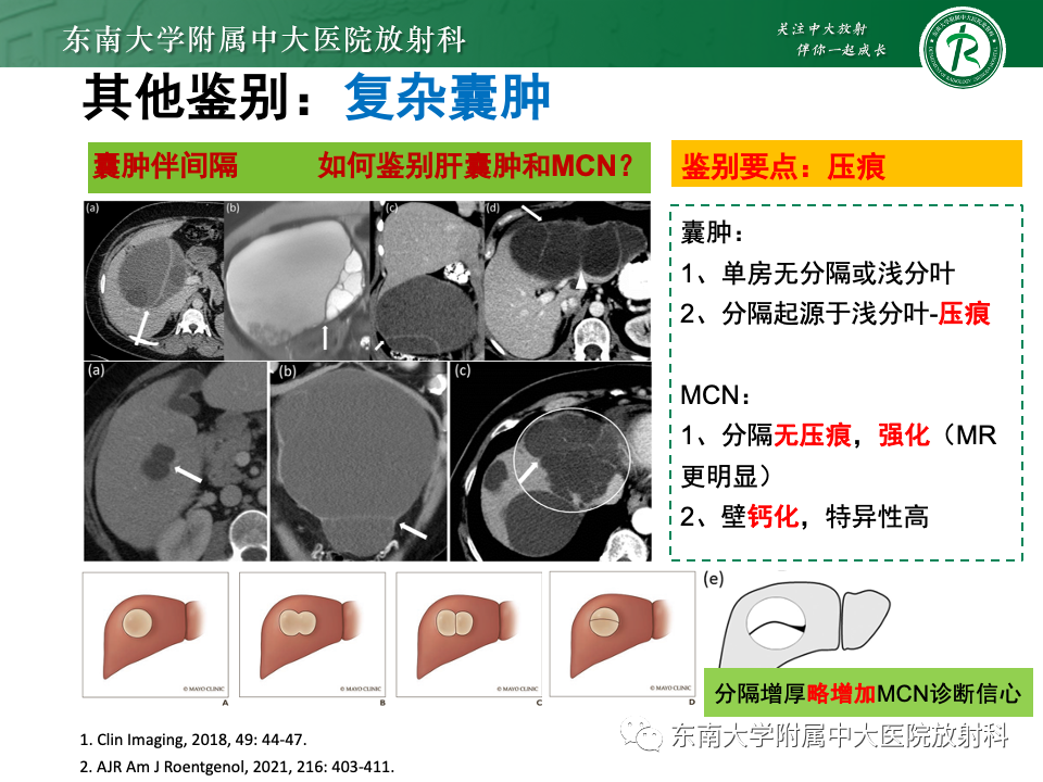 影像PPT - 【PPT】肝内多房囊性占位病例随访-43