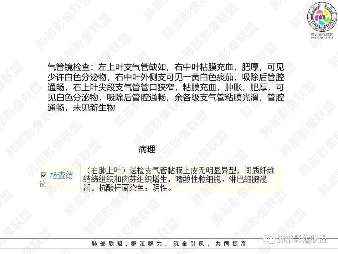 影像PPT - 【病例】变应性支气管肺曲霉病ABPA一例CT影像-44 影像PPT - 【病例】变应性支气管肺曲霉病ABPA一例CT影像-44