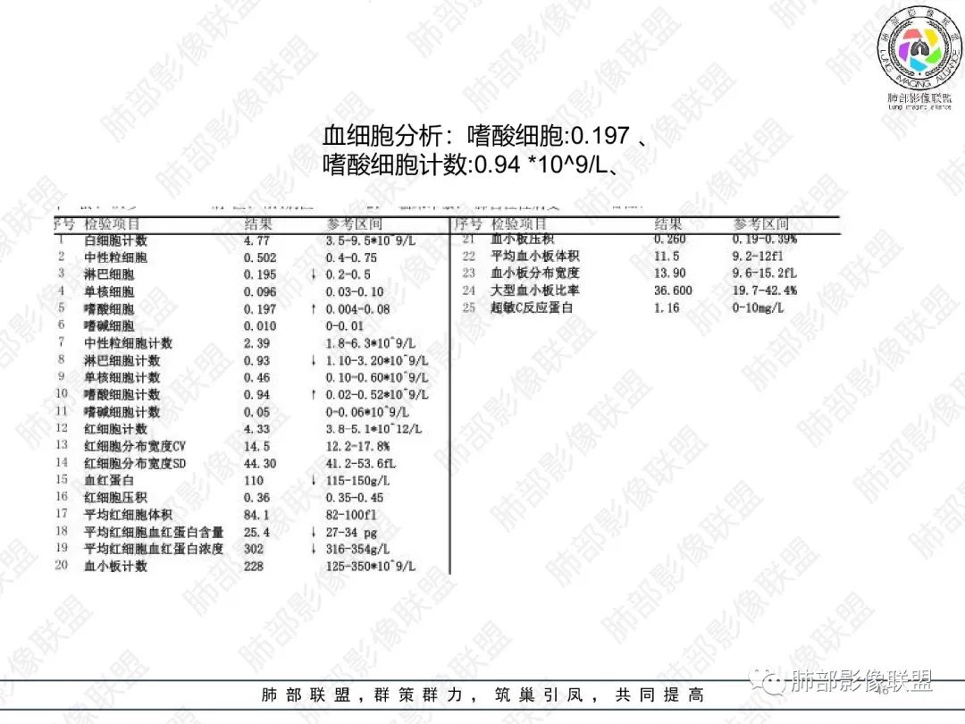 影像PPT - 【病例】变应性支气管肺曲霉病ABPA一例CT影像-45 影像PPT - 【病例】变应性支气管肺曲霉病ABPA一例CT影像-45