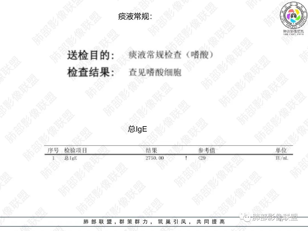 影像PPT - 【病例】变应性支气管肺曲霉病ABPA一例CT影像-46 影像PPT - 【病例】变应性支气管肺曲霉病ABPA一例CT影像-46