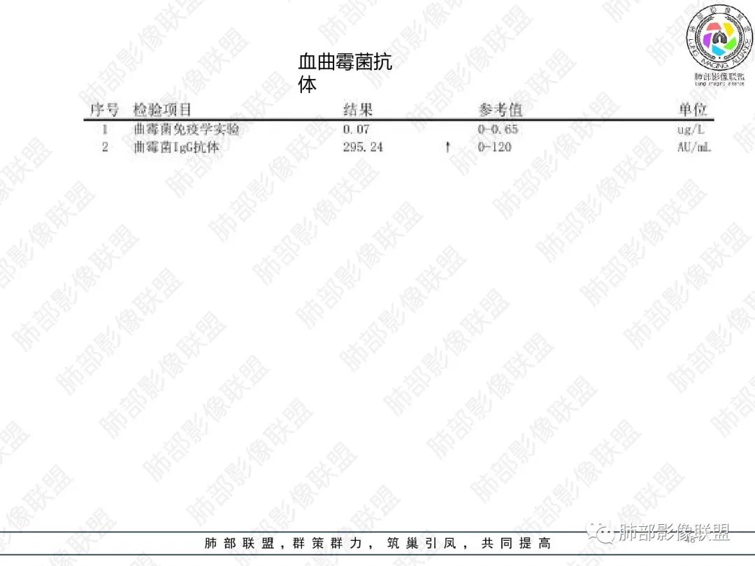 影像PPT - 【病例】变应性支气管肺曲霉病ABPA一例CT影像-47 影像PPT - 【病例】变应性支气管肺曲霉病ABPA一例CT影像-47