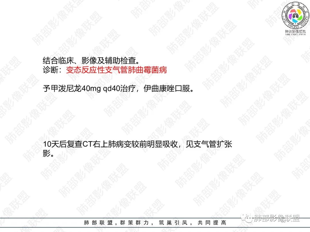 影像PPT - 【病例】变应性支气管肺曲霉病ABPA一例CT影像-49 影像PPT - 【病例】变应性支气管肺曲霉病ABPA一例CT影像-49