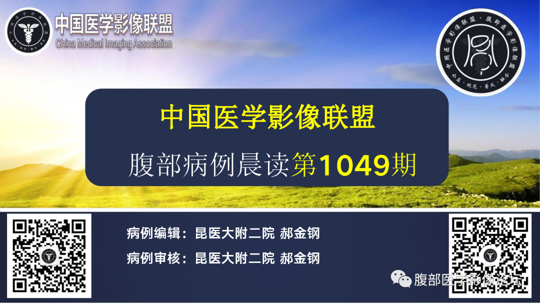 影像PPT - 【病例】肾脏黄色肉芽肿性肾盂肾炎1例CT及MR影像诊断-1