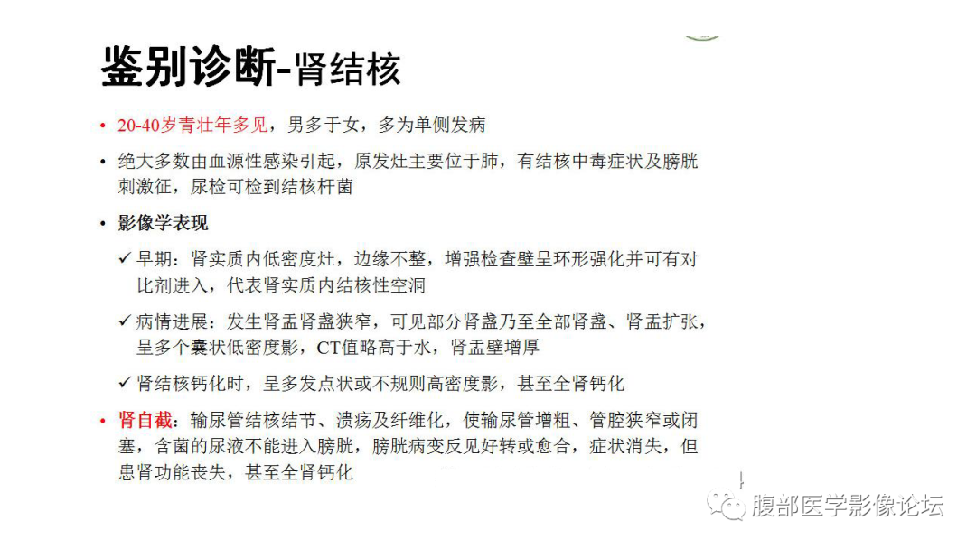 影像PPT - 【病例】肾脏黄色肉芽肿性肾盂肾炎1例CT及MR影像诊断-22
