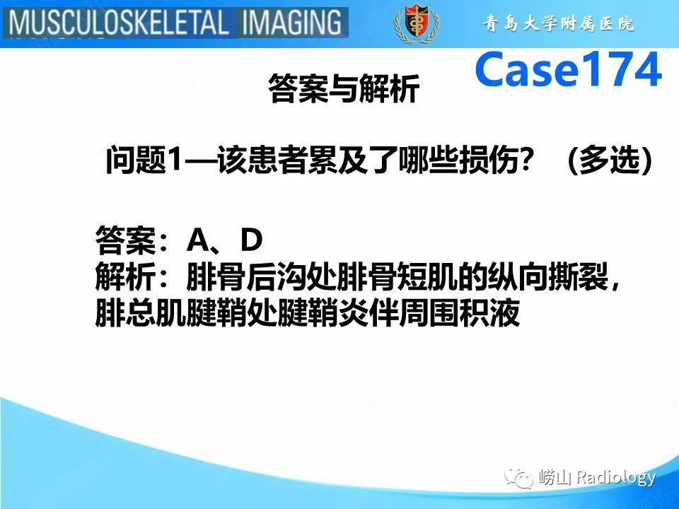 影像PPT - 【PPT】腓骨短肌腱撕裂-4