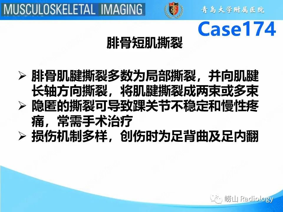 影像PPT - 【PPT】腓骨短肌腱撕裂-9