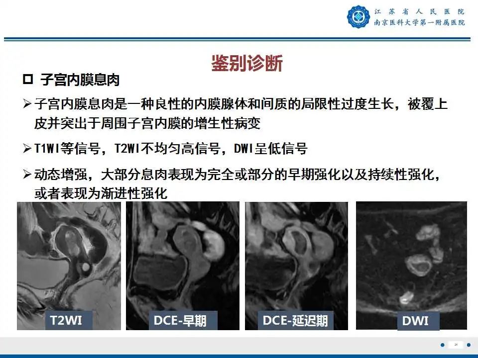 影像PPT - 【PPT】子宫内膜癌-31