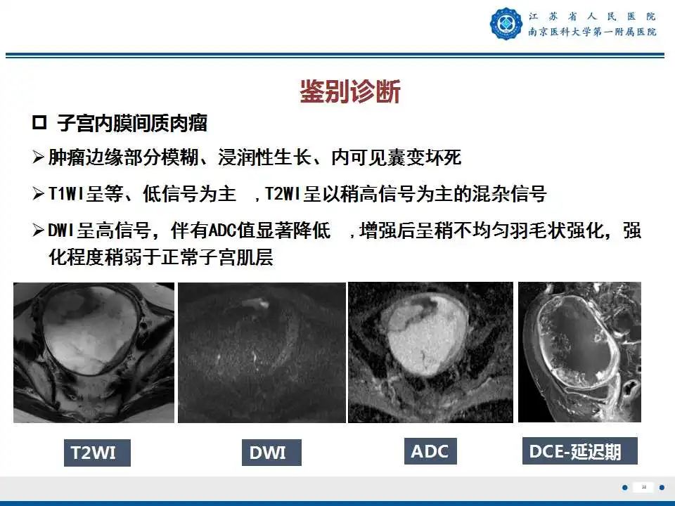 影像PPT - 【PPT】子宫内膜癌-32