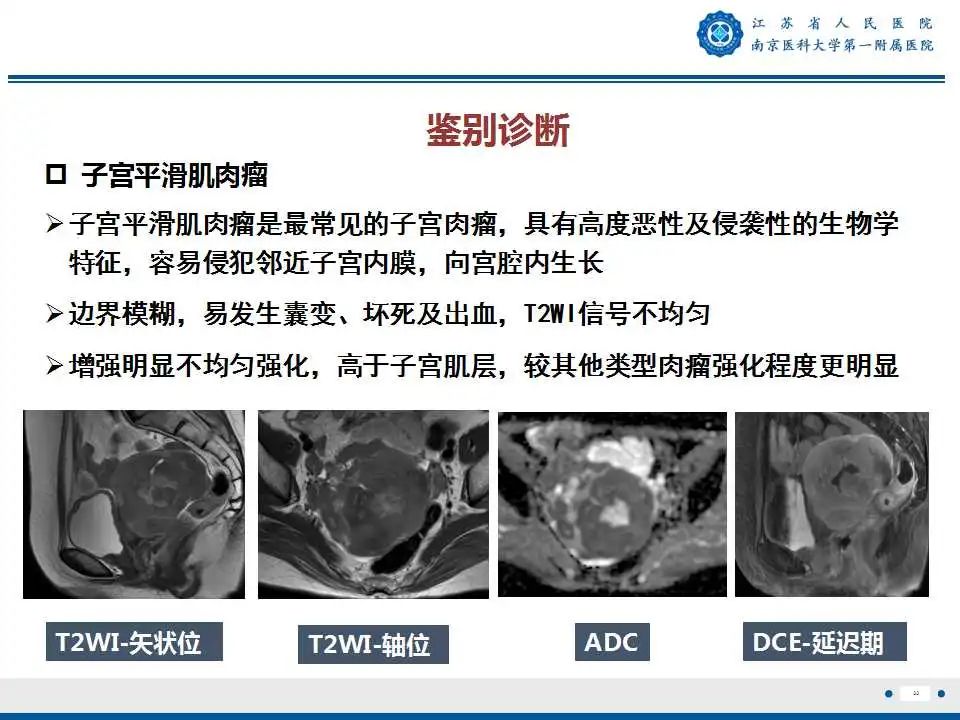 影像PPT - 【PPT】子宫内膜癌-33