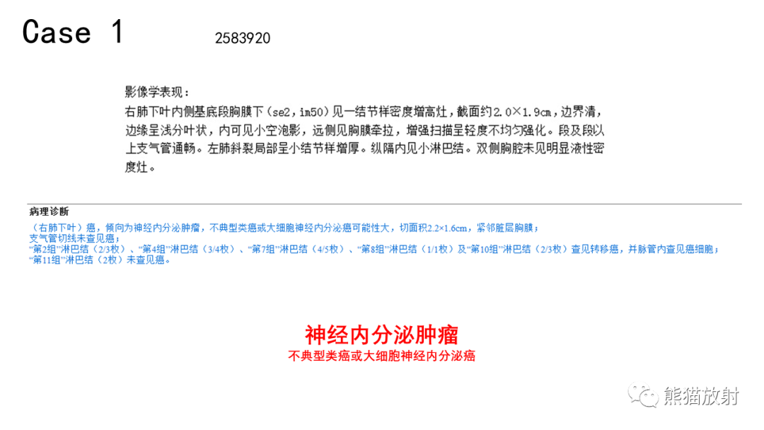 影像PPT - 【病例】肺神经内分泌肿瘤2例CT影像-15
