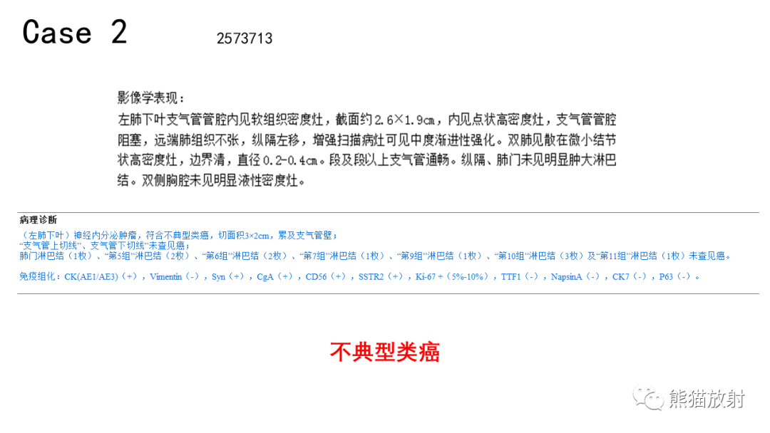 影像PPT - 【病例】肺神经内分泌肿瘤2例CT影像-16