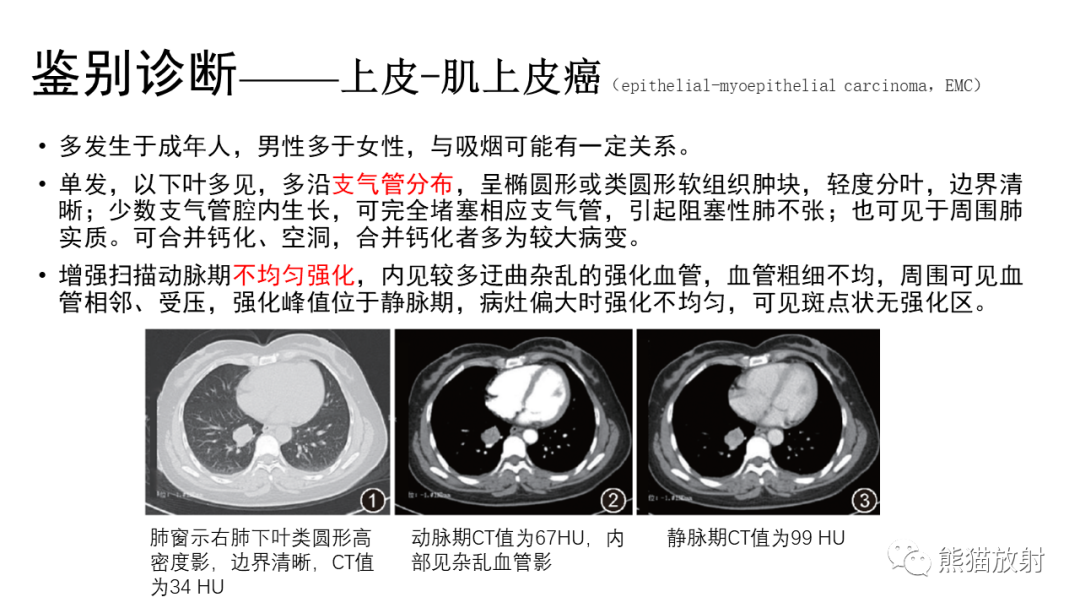 影像PPT - 【病例】肺神经内分泌肿瘤2例CT影像-30