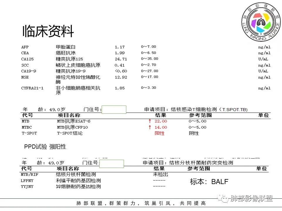 影像PPT - 【病例】隐源性机化性肺炎1例-4 影像PPT - 【病例】隐源性机化性肺炎1例-4