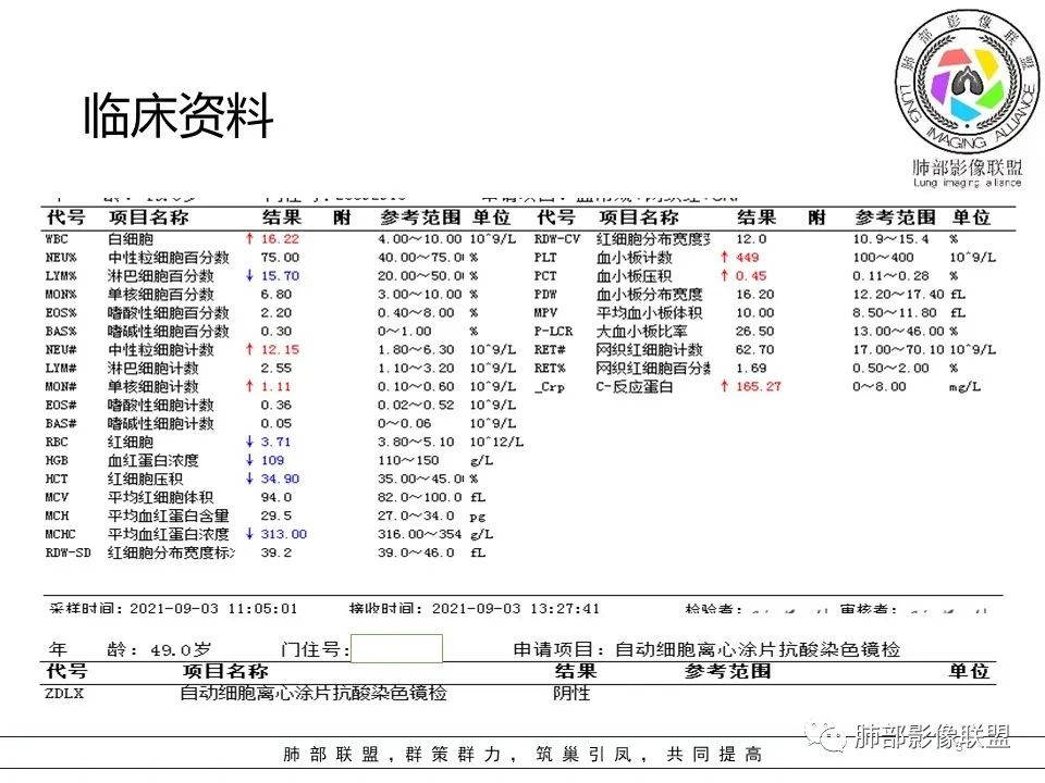 影像PPT - 【病例】隐源性机化性肺炎1例-3 影像PPT - 【病例】隐源性机化性肺炎1例-3