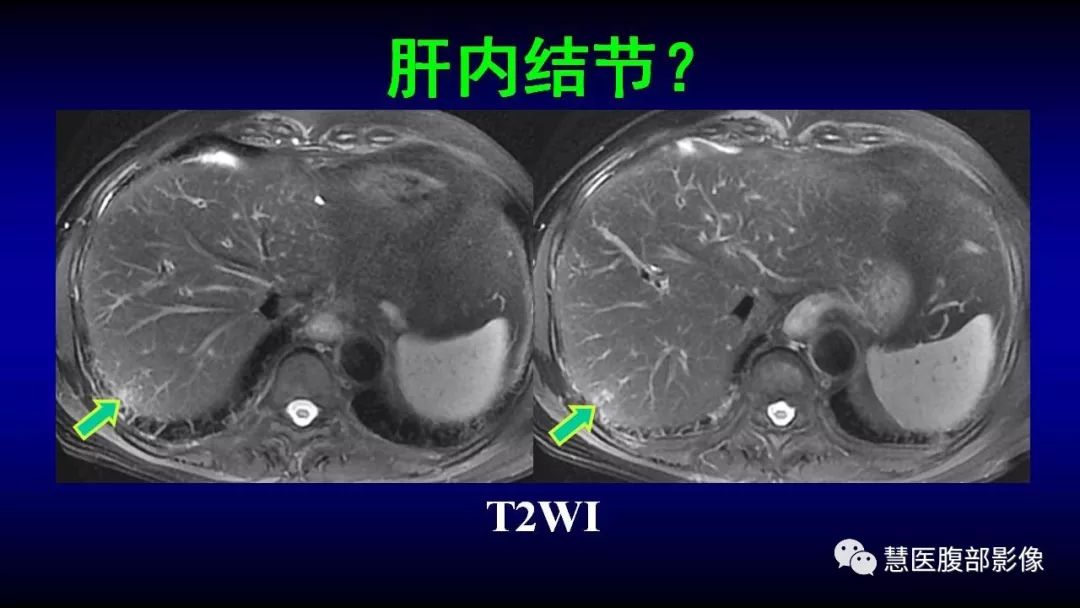 影像PPT - 【PPT】MRI临床诊断思路系列01-3