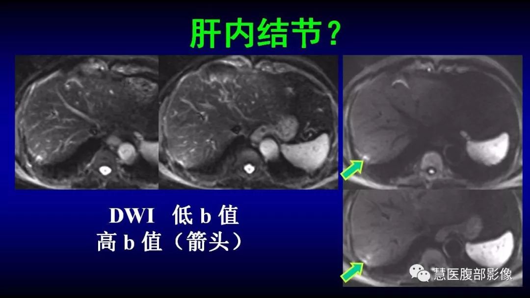 影像PPT - 【PPT】MRI临床诊断思路系列01-6