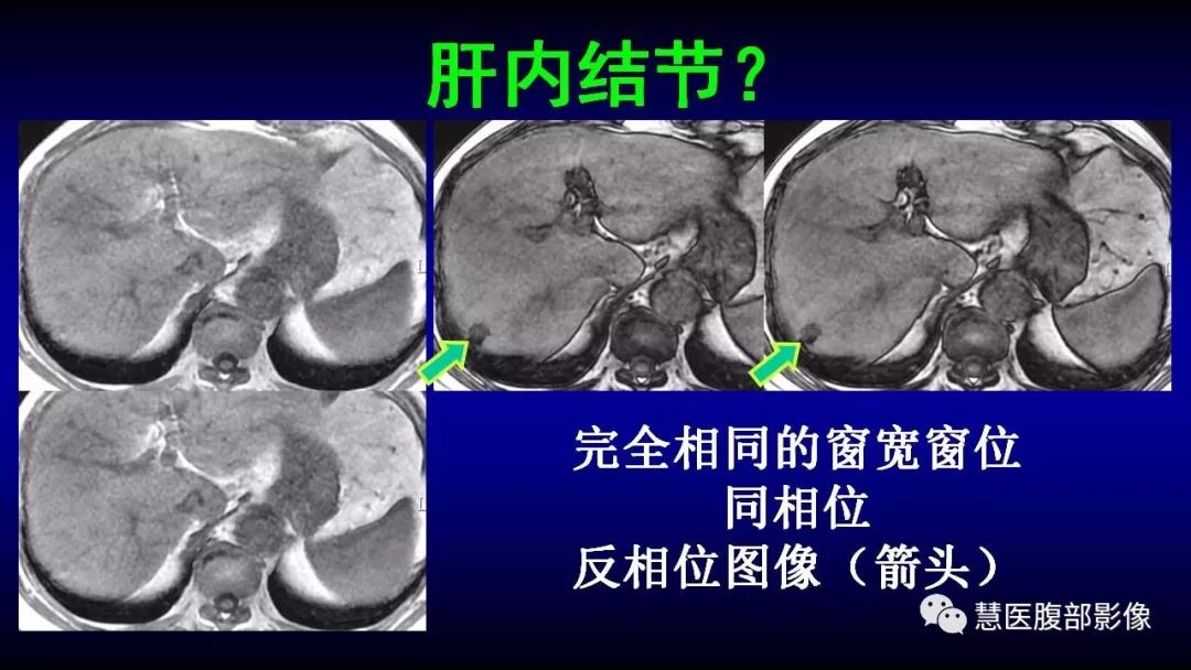 影像PPT - 【PPT】MRI临床诊断思路系列01-8