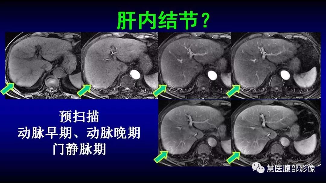 影像PPT - 【PPT】MRI临床诊断思路系列01-10