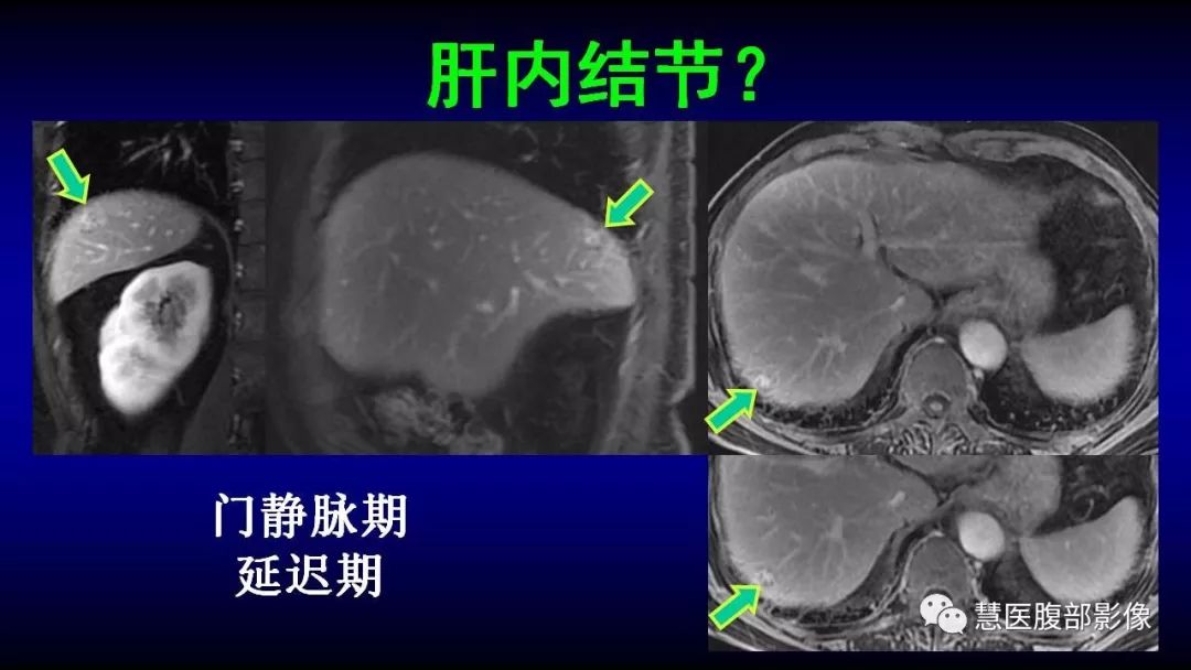 影像PPT - 【PPT】MRI临床诊断思路系列01-12
