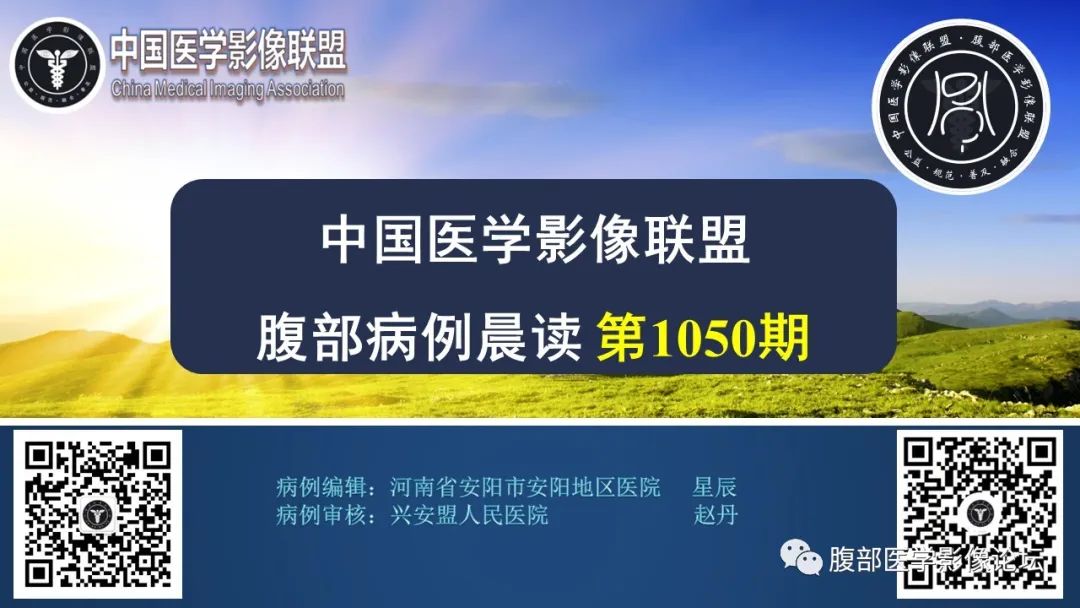 影像PPT - 【病例】急性淋巴细胞白血病累及肾脏1例CT影像表现-1