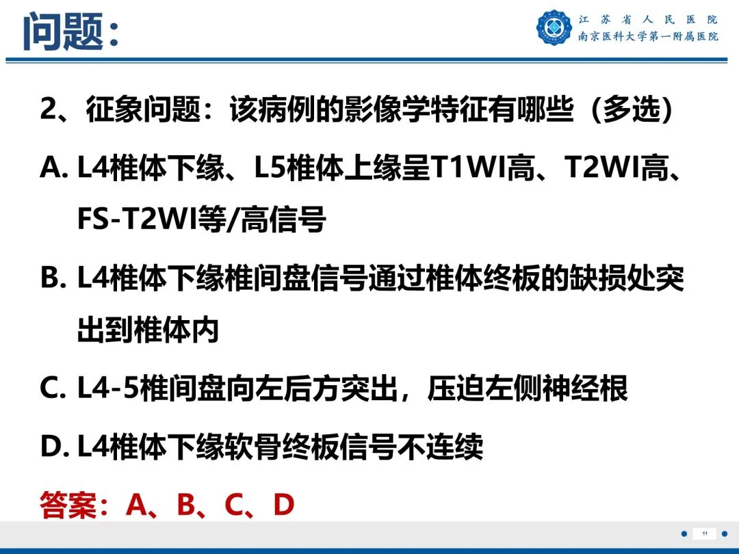 影像PPT - 【PPT】终板炎-12
