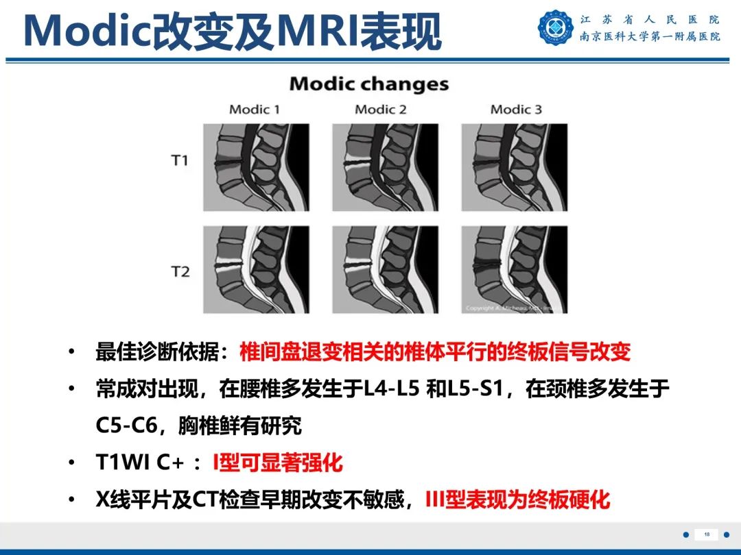 影像PPT - 【PPT】终板炎-19