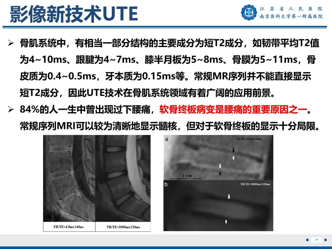 影像PPT - 【PPT】终板炎-28