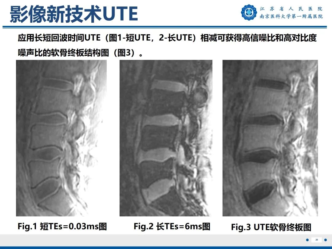 影像PPT - 【PPT】终板炎-29