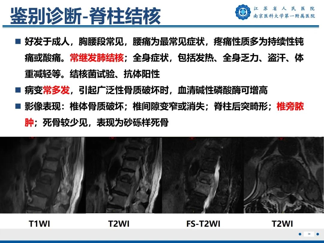 影像PPT - 【PPT】终板炎-35