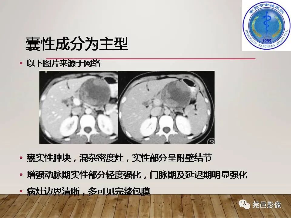 影像PPT - 【PPT】胰腺实性假乳头状瘤(SPTP)的CT诊断-23