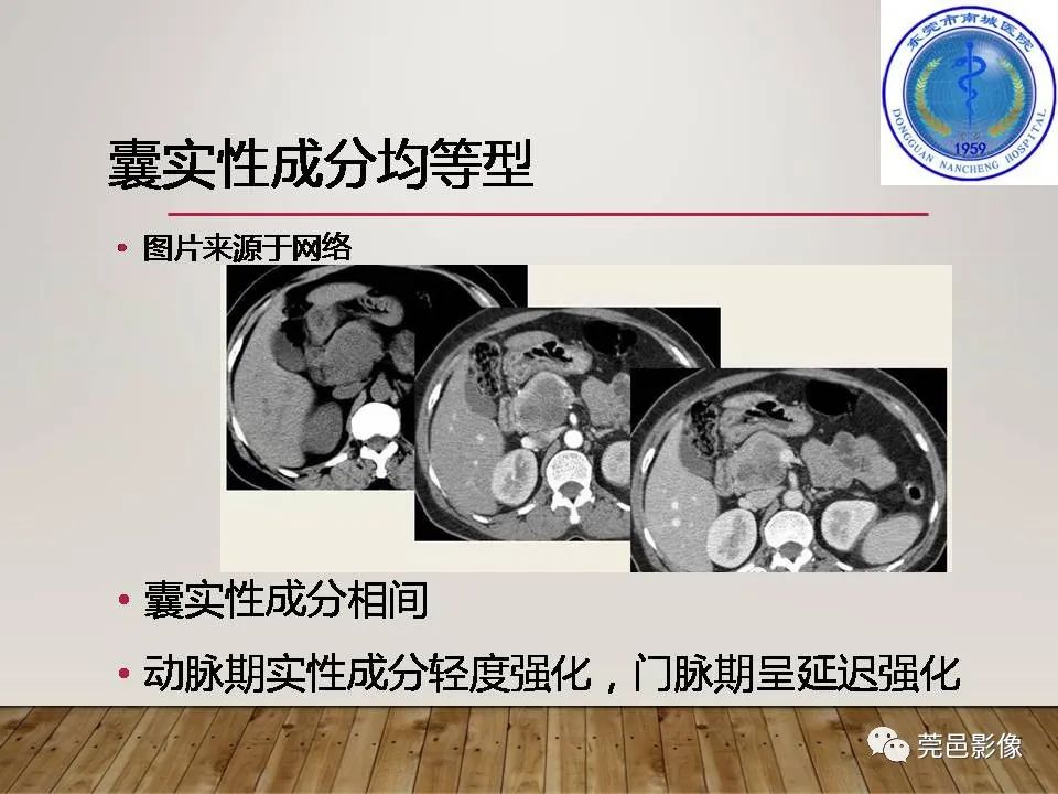 影像PPT - 【PPT】胰腺实性假乳头状瘤(SPTP)的CT诊断-24