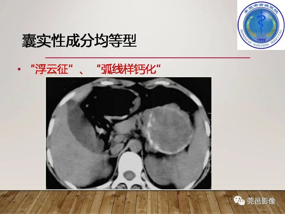影像PPT - 【PPT】胰腺实性假乳头状瘤(SPTP)的CT诊断-25